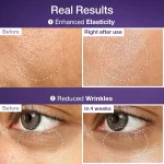 تاثیراسنس حلزون